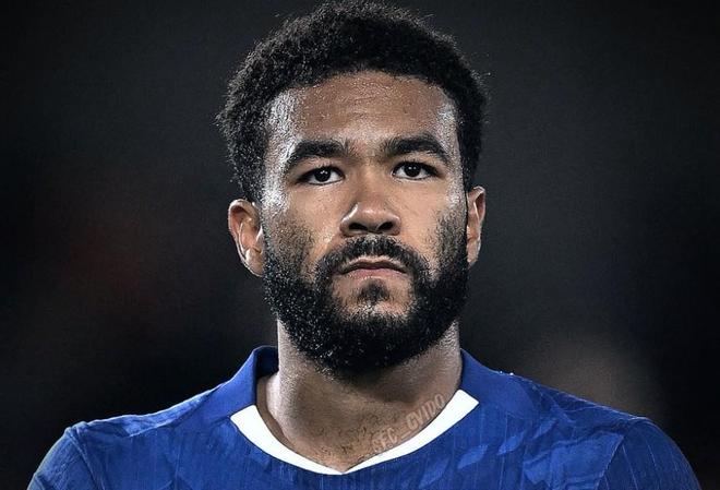 詹姆斯：面对领头羊我们毫无畏惧